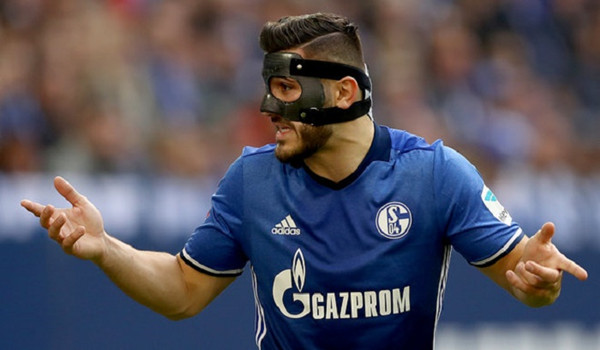 沙尔克VS多特蒙德，科拉希纳茨或无缘本轮鲁尔德比